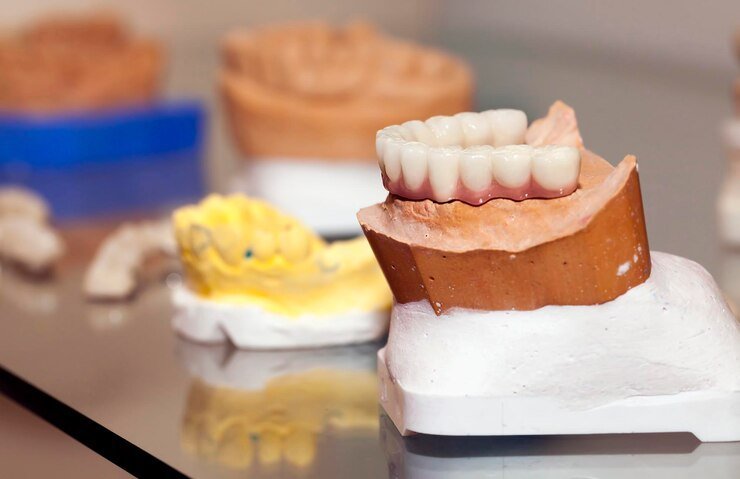 Dentures: Long-Term Solution for Missing Teeth
