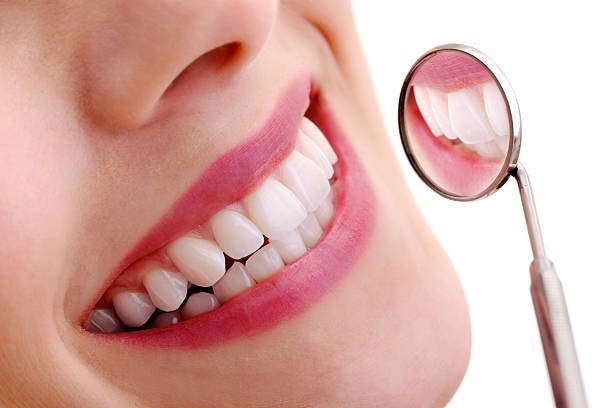 Achieve a Brilliant Smile: Teeth Whitening Services Available in Riyadh