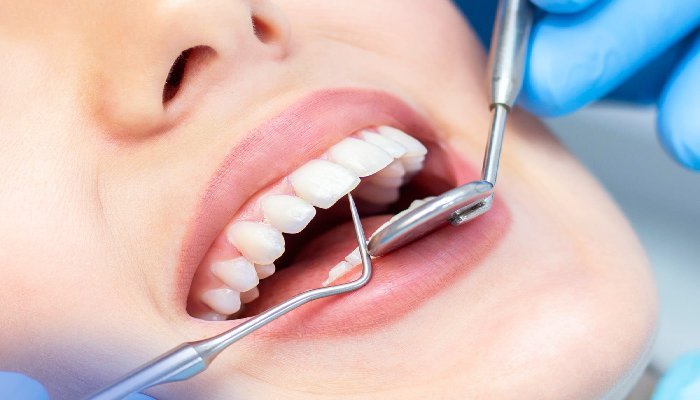 How to Solve Issues With Dental