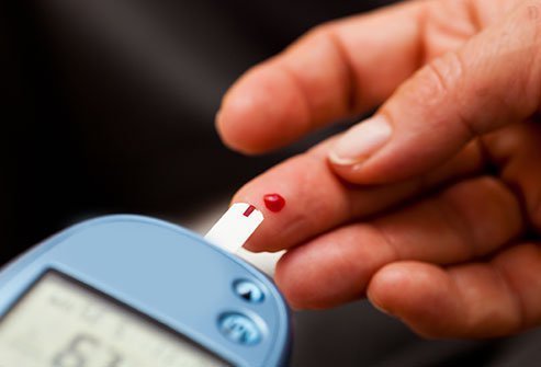 The Benefits of Using Buy Metformin for Diabetes Management
