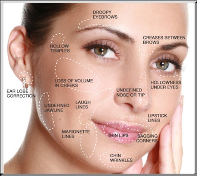 Unlock Your Confidence: Botulinum Toxin Injections in Riyadh