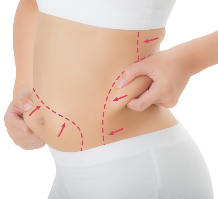 Understanding the Psychological Effects of Liposuction in Dubai
