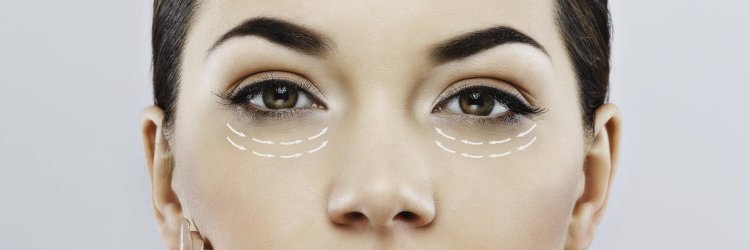Eyes that Mesmerize: Riyadh's Best Eyelid Surgery Doctor