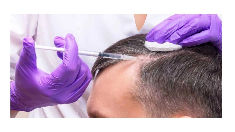 What Makes PRP Therapy a Breakthrough in Hair Loss Treatment?