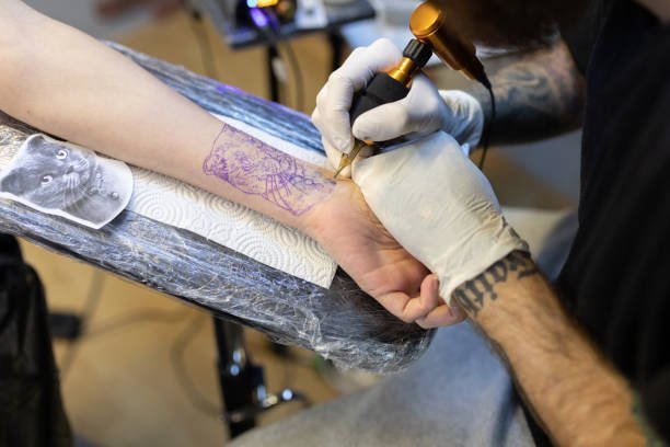 Clean Canvas: Tattoo Removal Clinics in Riyadh