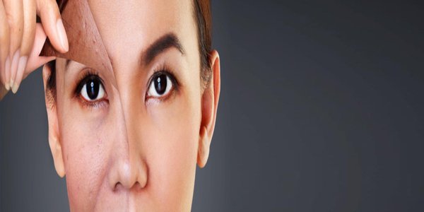 Skin Concerns Corrected By Chemical Peel Treatment