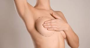 Nipple Reduction with Fat Transfer Dubai Options for Breast Refinement