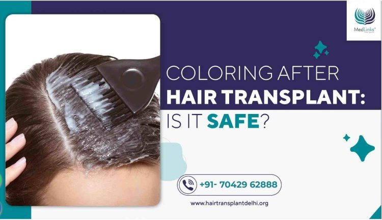 Coloring After Hair Transplant: Is It Safe