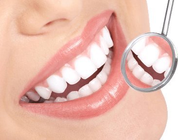 The Complete Guide to Teeth Whitening in Riyadh