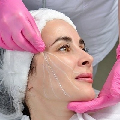 How Long Do Thread Lift Results Last in Islamabad?