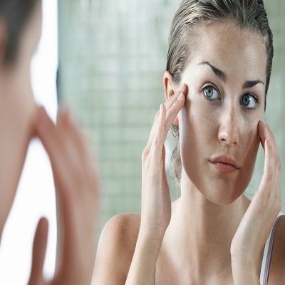 Can melasma return after treatment?